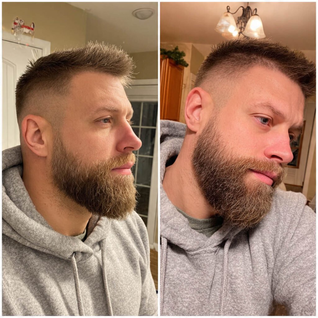 Short Sides, Full Chin beard style