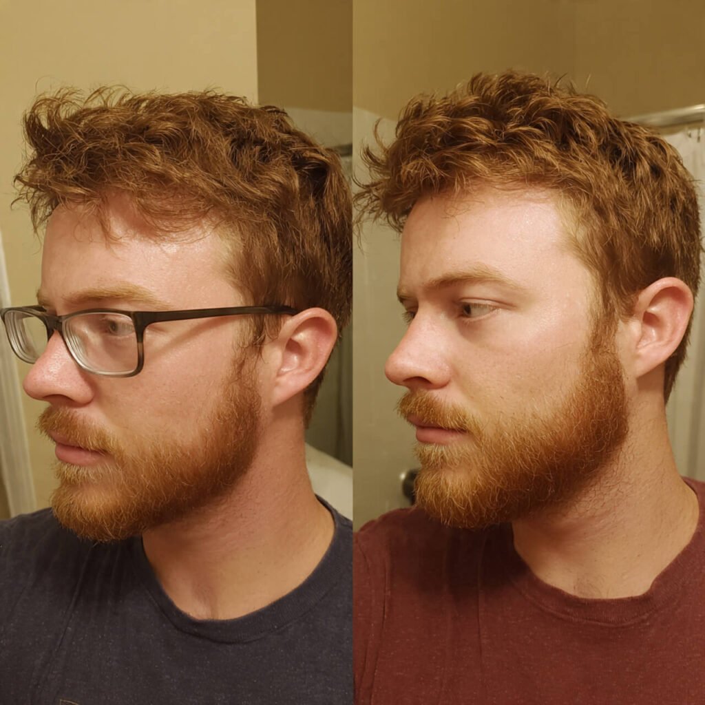 Circle Beard style