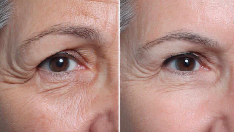 Expecting Immediate Results From Anti Aging Products