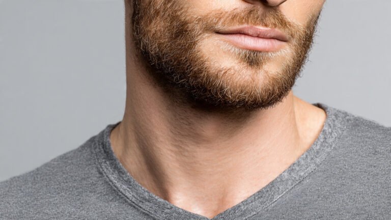 Razor Bumps Solution with Permanent Beard Line
